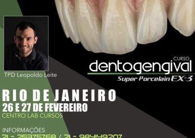 Curso Dentogengival Super Porcelain EX-3 – 26 e 27 de fevereiro