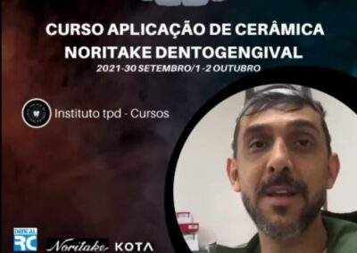 Curso Aplicação de Cerâmica Noritake Dentogengival – 30 de setembro 1 e 2 de outubro