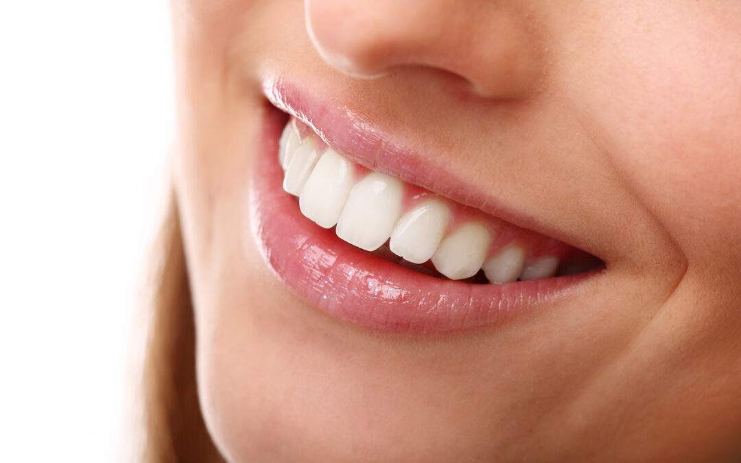 Facetas dentárias: quais os segredos para escolher a ideal?